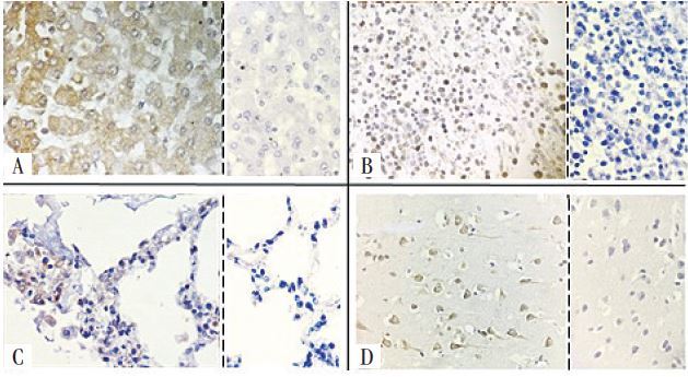 ISH reactions for RNA detection. Photomicrography of the CISH
							reaction for ribosomal RNA 28S A) liver; B) spleen; C) lung; D) brain;
							magnification 40&times;. It is possible to observe the brown precipitate in
							the nucleus and cellular cytoplasm resulting from the enzymatic reaction
							of the DAB with the peroxidase of the complex of antibodies bound to the
							hybrid formed between the target sequence and the probe in the reactions
							with the positive (right) probe in comparison to the reactions with the
							negative probe (left).