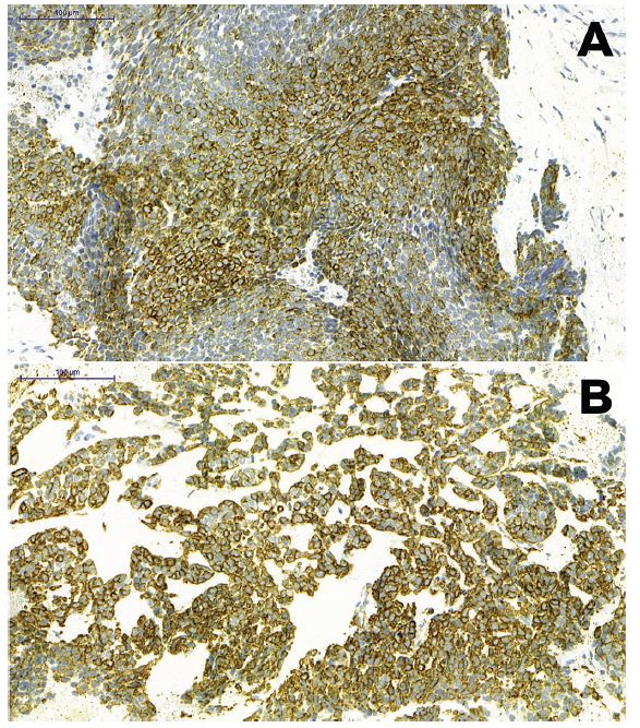 Immunohistochemistry