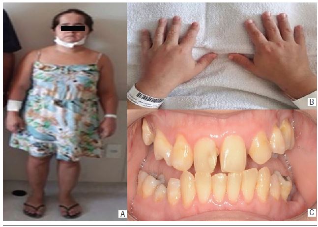 Extraoral and intraoral clinical features of patient case
                                2