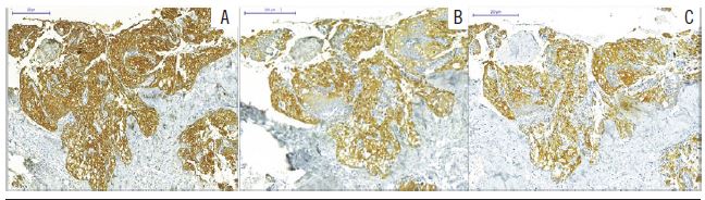 Immunohistochemistry