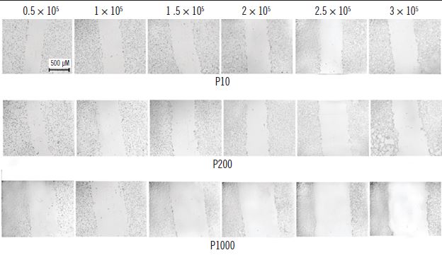 U87MG cell monolayer and in vitro wound healing assay standardization A) U87MG cells were plated at different densities and after 24 hours of incubation, they were photographed to observe the confluence of cell monolayers. At 0.5 and 1 × 105 cells per well the cellular monolayer presented low confluence and at 2.5 and 3 × 105 cells per well the cells began to overlap each other; B) the monolayer was then wound wounded with three micropipette tips sizes. The 1.5 and 2 × 105/500 μl cell densities presented optimal confluence to perform the assay.