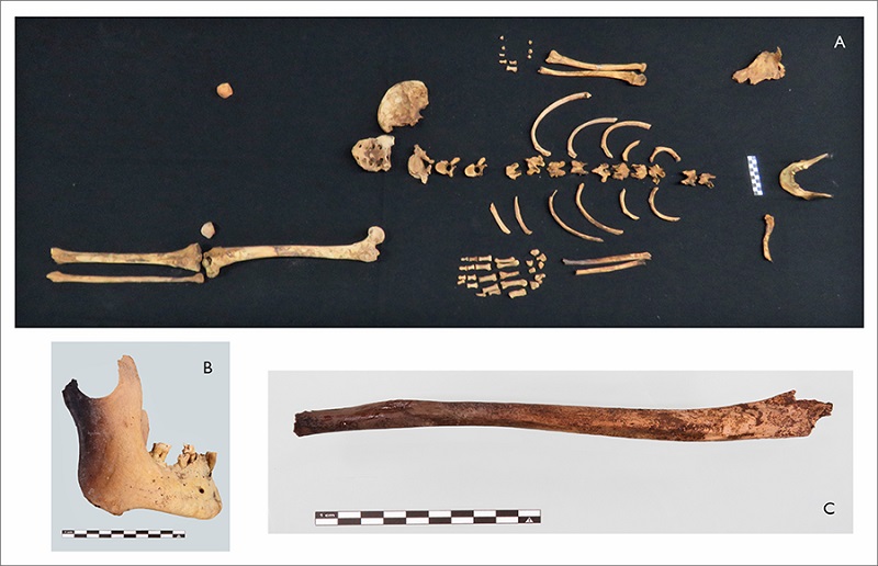 Ossos perturbados do indivíduo 13, sepultamento 3, Toca do Enoque: A) ossos preservados do esqueleto após a perturbação antrópica; B-C) mandíbula e ulna esquerda com sinais leves de queima.