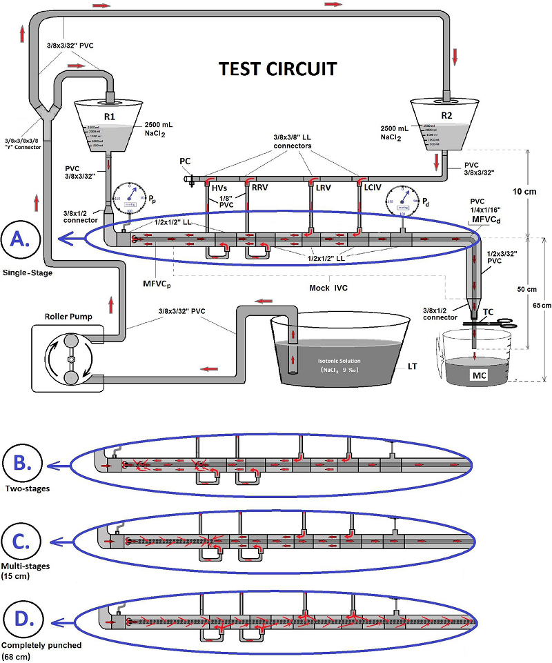 Schematic test circuit design of the four mock femoral venous
                                cannulas, components of the mock circuit and fluid flow directions:
                                single-stage (A), two-stage (B), multi-stage (C), completely punched
                                (D). HVs=hepatic veins; IVC=inferior vena cava; LCIV=left common
                                iliac vein; LL=luer lock; LRV=left renal vein; LT=liquid tank;
                                MC=measuring cup; MFVCd=mock femoral venous cannula (distal side);
                                MFVCp = mock femoral venous cannula (proximal side); PC=plastic
                                clamp; Pd=distal pressure; Pp=proximal pressure; PVC=polyvinyl
                                chloride; R1=reservoir 1 (presents the blood volume of right atrium
                                and superior vena cava; R2=reservoir 2 (presents the blood volume of
                                inferior vena cava and lower limps); RRV=right renal vein; TC=tubing
                                clamp