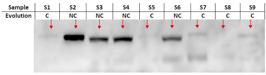 Myocardial expression of heat-shock protein 70 (HSP 70) and evolution
							outcome. C=complicated; NC=non-complicated