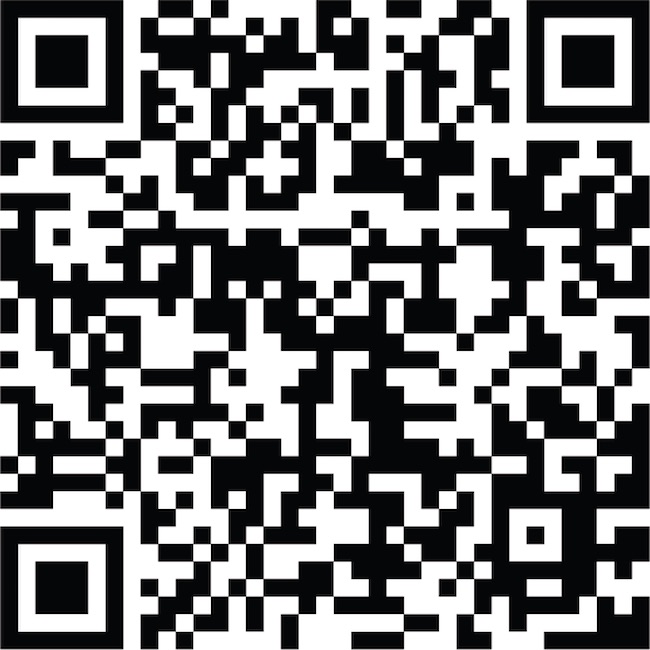 Transthoracic echocardiography, Doppler evaluation: bidirectional flow between the left ventricle and the left ventricular pseudoaneurysm cavity.