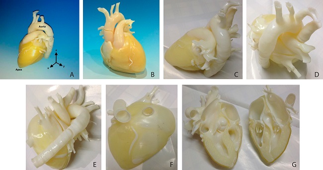 A) &ndash; Three-dimensional printed normal heart bio model. The myocardium
							(yellow area) is clearly visible in the model (left anterior oblique 60˚
							view). B) - Posterior anterior view of heart model. C) - Left lateral
							view of the heart model. D) - Craniocaudal (superior) view of the heart
							model. E) - Posterior view of the heart model. F) - Inferior (caudal)
							view of the heart model. G) - Cross-sectional view of the heart
							model.