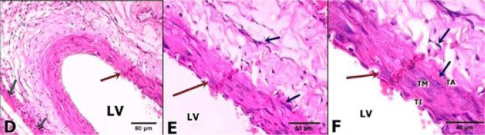 D, E and F belonging to the Chitosan Group (ChG) In D
									(20x magnification), a discrete hematic infiltrate is observed
									in the vascular wall, as well as a quantity of leukocytes and
									fibroblasts, in a more preserved tissue area. Details in E (40x)
									and F (60x) with clear division of the tunic intima (TI), media
									(TM) and adventitia (TA), closer to the great support of
									collagen fibres and elastic fibres. Note green arrows in D
									indicate the presence of degraded remnants of
								chitosan.
