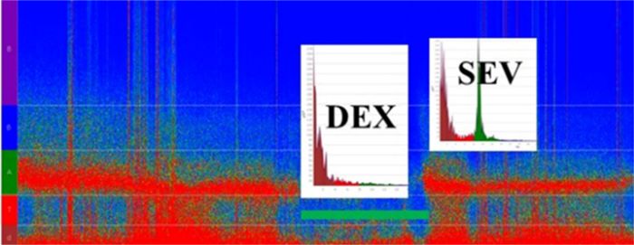 Spectrogram of a frontal channels (Fz-F8) recording during
                                anesthesia for atrial septal defect correction of a seven-year-old
                                patient maintained with remifentanil (0.1-0.3 &micro;g/kg/min),
                                dexmedetomidine (DEX) (1 &micro;g/kg/h), and sevoflurane (SEV)
                                (expiratory concentrations: 0.5-2.2 %). DEX corresponded to a period
                                when no sevoflurane was administered, and a typical
                                DEX-electroencephalogram (EEG) signature (delta frequency band
                                dominance) could be seen. SEV (2.2 %) was given after weaning off
                                the cardiopulmonary bypass (green line), producing the sevoflurane
                                EEG signature (delta and alpha frequency bands dominance).