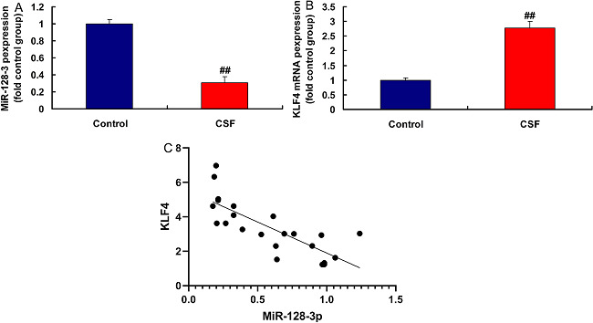 Micro ribonucleic acid (MiR)-128-3p and Kruppel-like factor (KLF)
								4 expressions in the coronary slow flow (CSF) model (A and B), miR-
								128-3p expression had a negative correlation with KLF4 levels in the
								rat model (C). Control, normal volunteer group; CSF, CSF patients
								group. ##P<0.01 compared with normal volunteer group.
								mRNA=messenger ribonucleic acid