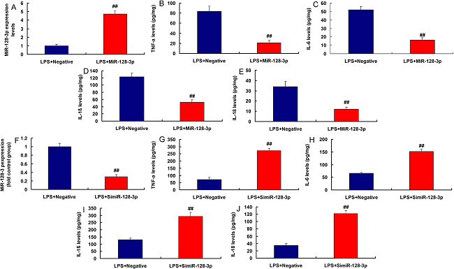 Micro ribonucleic acid (MiR)-128-3p regulated inflammation in the
								in vitro model. MiR-128-3p expression (A), tumor necrosis factor
								alpha (TNF-α), interleukin (IL)-6, IL-1β, and IL-18 (B, C, D, and E)
								in overexpression of miR-128-3p group; miR-128-3p expression (F),
								TNF-α, IL-6, IL-1β, and IL-18 (G, H, I, and J) in downregulation of
								miR-128-3p group. LPS+Negative, LPS-induced in vitro model by
								negative mimics group; LPS+miR-128-3p, LPS-induced in vitro model by
								miR-128-3p group. ##P<0.01 compared with LPS+Negative
								group. LPS=lipopolysaccharide
