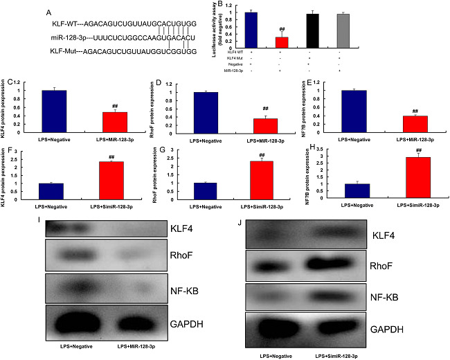 Kruppel-like factor (KLF) 4 is a target spot of micro ribonucleic
								acid (MiR)-128-3p on the inflammation in vitro model. The luciferase
								reporter plasmid containing wild type (WT) or mutant (Mut) KLF4 was
								cotransfected with miR-128-3p (A and B), KLF4, RhoF, and nuclear
								factor kappa B (NF-κB) protein expressions (C, D, E, and I) by
								overexpression of miR-128-3p; KLF4, RhoF, and NF-κB protein
								expressions (F, G, H, and J) by downregulation of miR-128-3p.
								LPS+Negative, LPS-induced in vitro model by negative mimics group;
								LPS+miR-128-3p, LPS-induced in vitro model by miR-128-3p group;
								LPS+simiR-128-3p, LPS-induced in vitro model by simiR-128-3p group.
									##P<0.01 compared with LPS+Negative group.
								GAPDH=glyceraldehyde-3-phosphate dehydrogenase;
								LPS=lipopolysaccharide
