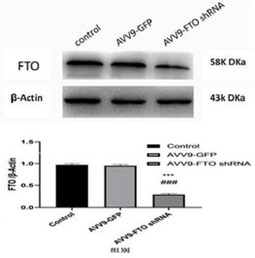 Western blot results of fat mass and obesity-associated gene
								(FTO) protein expression in the vulnerable plaque group, empty load
								group, and FTO knockdown group. ***P<0.001 vs. control group;
								###P<0.001 vs. AVV9-GFP group. AVV9=adeno-associated virus-9;
								GFP=green fluorescent protein; shRNA=short hairpin ribonucleic
								acid.