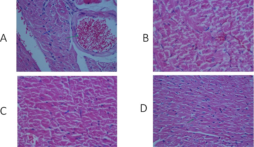 Histopathological examination of heart tissue belonging to the
								groups. A) Sham group, B) dobutamine group, C) dobutamine + fuziline
								group, and D) fuziline group. Green arrows indicate normal myocyte
								cells. Blue arrows indicate myocyte necrosis.