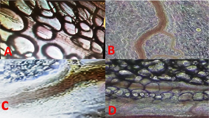 Methylene blue (MB) inhibiting neutrophil leukocyte
rolling/adhesion after lipopolysaccharide (LPS) intravenous dose.
(A) Postcapillary venules of saline group (saline at zero and 15
min); (B) postcapillary venules of LPS group (LPS at zero and saline
at 15 min); (C) postcapillary venules of only MB (MB at zero and
saline at 15 min); (D) postcapillary venules of MB after LPS doses
(LPS at zero and MB at 15 min). # Intra peritoneal image of
postcapillary venules. (A) Control (roller mean = 52.4, adhesion
mean = 1.3); (B) LPS + salina (roller mean = 816, adhesion mean =
9.4); (C) LPS + MB (roller mean = 28.1, adhesion mean = 3.2); (D) MB
+ LPS (roller mean = 76.4, adhesion mean = .6).