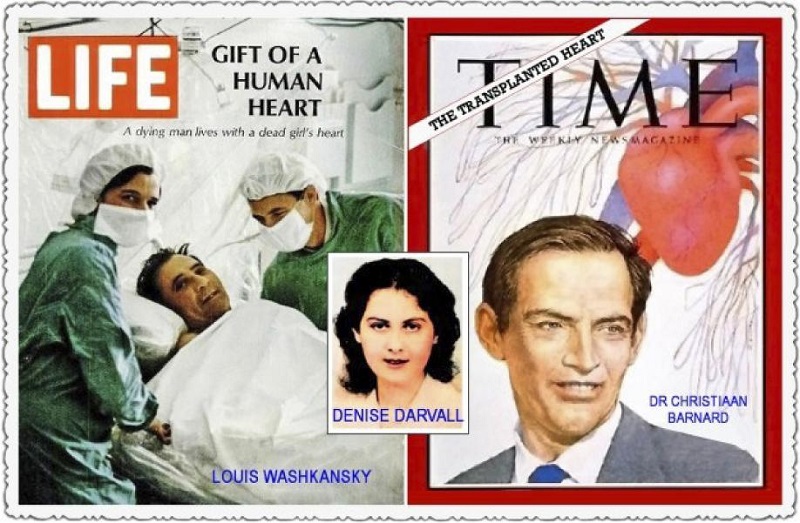 Christiaan Barnard and the first donor (center) and recipient of
                                heart transplant (left) in December 3, 1967. Barnard said: Her heart
                                was willing, but his body was weak.