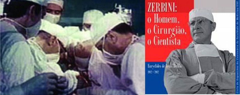 Zerbini and his surgical team (left) performing the first heart
                                transplant in Brazil, 1968. The man, the surgeon, the scientist
                                (right).