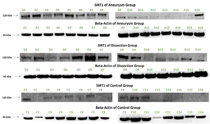Sirtuin 1 (SIRT1) Western Blot image.