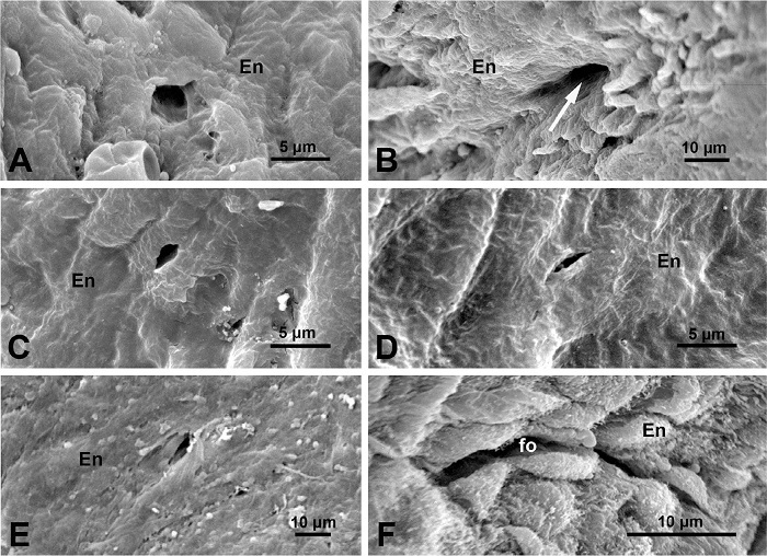 Scanning electron microscopy of luminal intima of a human great
							saphenous vein harvested as graft with the no-touch method. A) An
							intimal opening (~ 5 μm) is seen within the endothelium (En); the
							possibility was considered that the opening was a part of the vasa
									vasorum[12].
							B) A blood vessel opening (> 10 μm), possibly a vasa vasorum or more
							likely a tributary branch that opens at the graft lumen. The arrow
							indicates a possible direction of blood flow on completion of coronary
							artery bypass grafting. C-E) Note examples of small (< 5 μm) intimal
							openings (&lsquo;channels&rsquo;) of various shapes. F) An elongated opening perhaps
							to a small fold as illustrated in Figure
								2D. It is acknowledged that A) image is from Dreifaldt et
									al.[12], 2011;
							B) is modified from Loesch and Dashwood[13], 2021; C), D), and E) are from A.
							Loesch unpublished study; and F) is modified from Vasilakis et
									al.[5],
							2004.