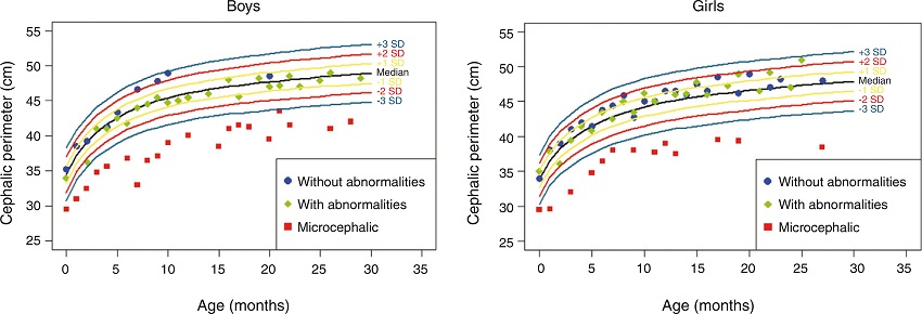 Head circumference evolution in the first 2.5 years of life in a
                                cohort of 29 children whose mothers were exposed to Zika virus
                                during pregnancy, five of whom had congenital microcephaly and
                                severe neurological impairment, 11 normocephalic children at birth,
                                with some type of neurological abnormality detected during
                                follow-up, and 13 normocephalic children at birth, without
                                neurological abnormalities during follow-up.