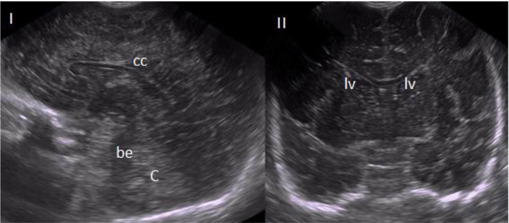 Normal TU image used in the theoretical-practical performance
                            evaluation in sagittal (I) and coronal (II) sections, respectively.
                            Personal archive.