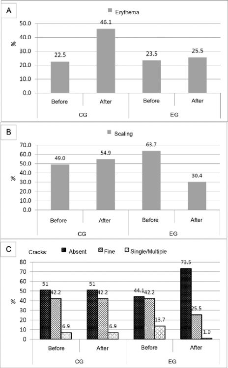 Distribution of frequency of erythema, scaling and degree of
                                moisture level in newborns before and after a bath in control and
                                study Groups.