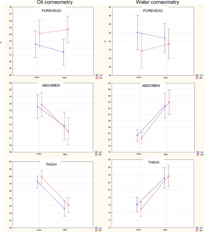 Distribution of percentage of oil and water corneometry on the
                                forehead, abdomen and thigh of newborns before and after bathing in
                                the control and experimental groups.