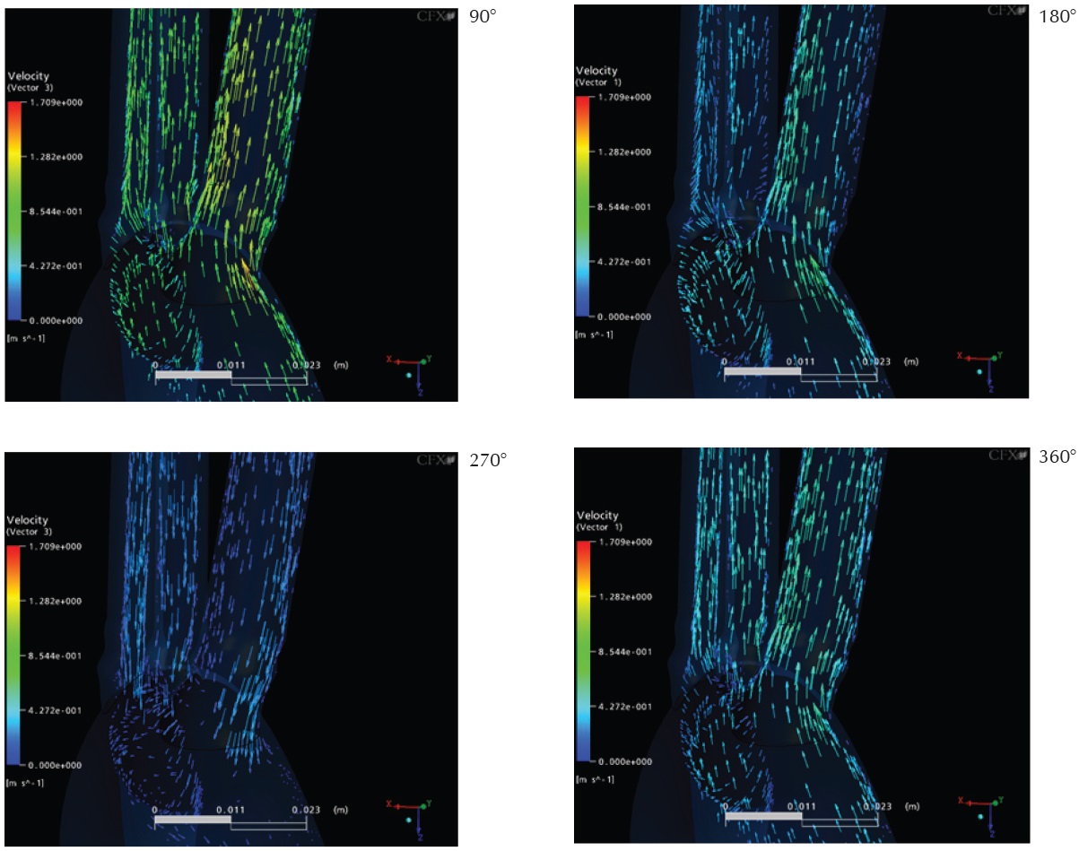 Vectores de velocidad en el cayado a&oacute;rtico, tronco braquiocef&aacute;lico y car&oacute;tida izquierda