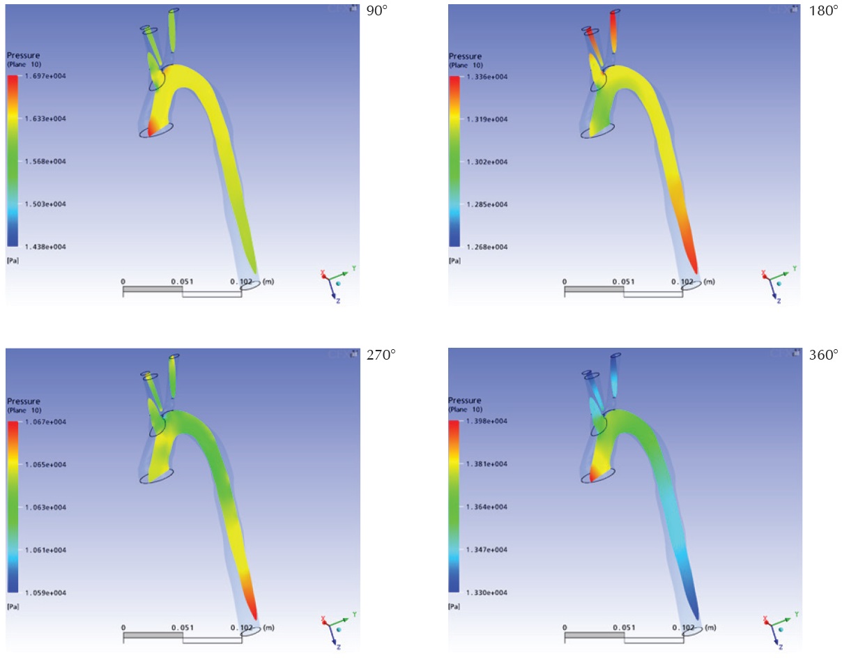 Distribuci&oacute;n de presi&oacute;n en un plano coronal aproximadamente congruente con el eje del dominio