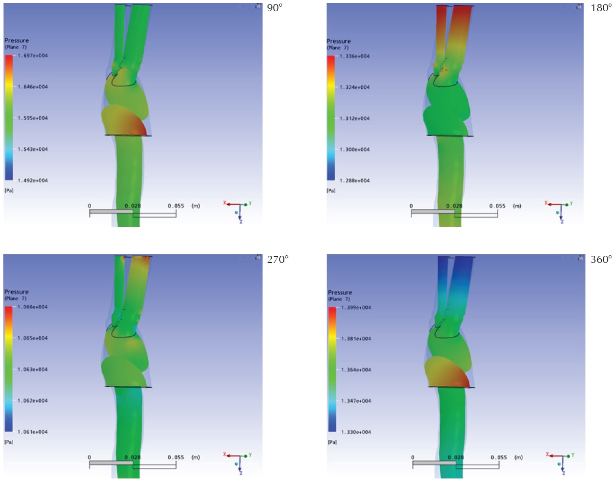 Distribuci&oacute;n de presi&oacute;n