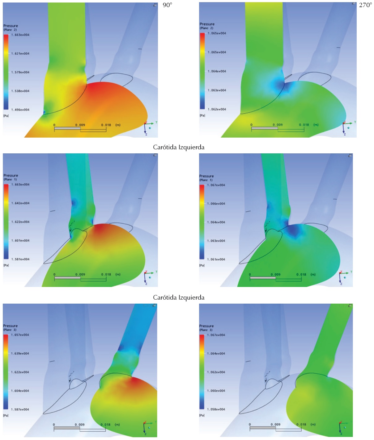 Detalle de la distribuci&oacute;n de presiones a los 90o y 270o del ciclo cardiaco en la ra&iacute;z de las tres ramas del cayado a&oacute;rtico