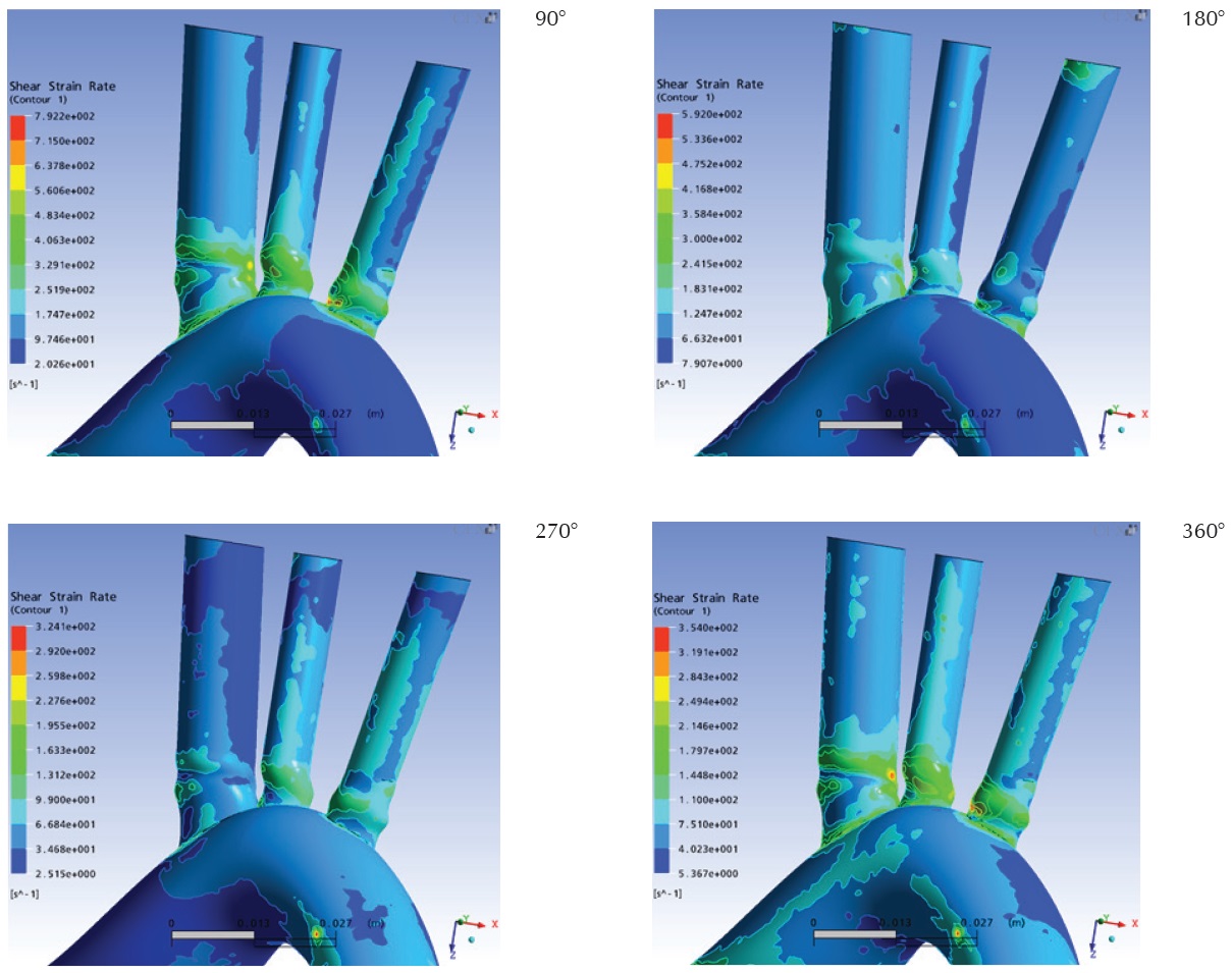 Tasa de cizallamiento sobre las paredes vasculares, vista anterior