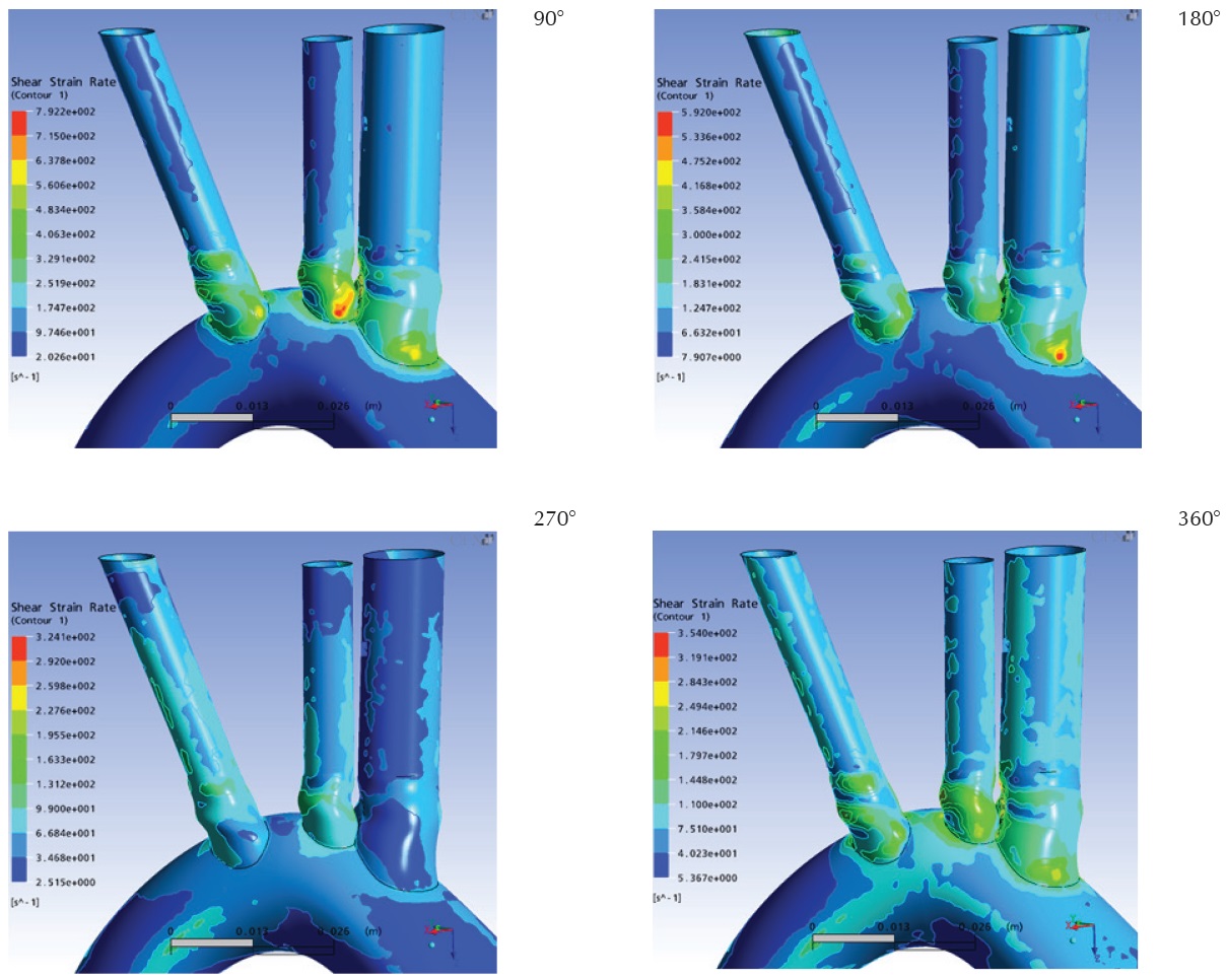 Tasa de cizallamiento en las paredes vasculares, vista posterior