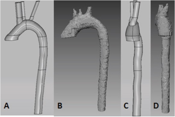 Comparaci&oacute;n de la TAC (B y D) con la reconstrucci&oacute;n geom&eacute;trica (A y C)