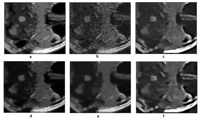 Visual comparison of results in Table 1, a) Original Image, b) Noisy image, c) Wavelet LMS method, d) Proposed NLRD method, e) NCSR method, f) ASDS method σ = 40