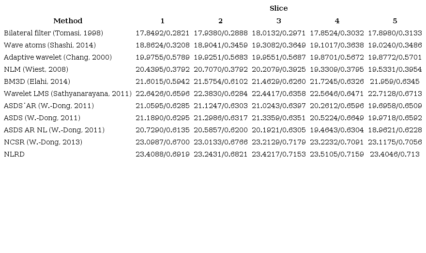 1: PSNR/SSIM comparison of the proposed model NLRD versus other methods with σ = 30