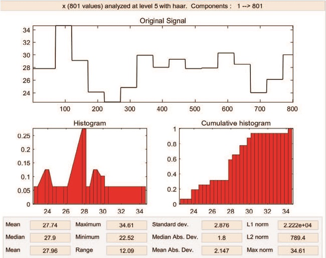 Vibration signal-Wavelet Transform-10 am
