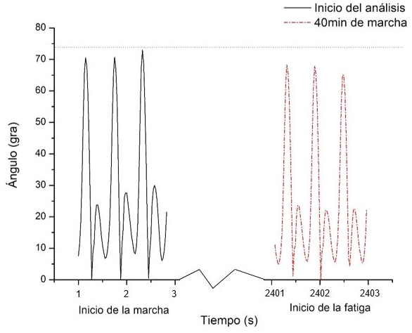 Análisis de marcha con bomba aspersora de gasolina de tipo mochila de
							S1