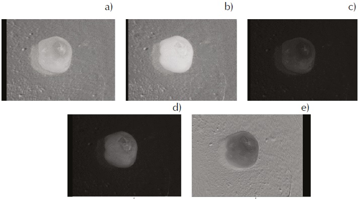 Resultados de la aplicaci&oacute;n de &iacute;ndices de vegetaci&oacute;n: NDVI, b) GNDVI, c) RVI, d) GVI, e) NGRDI