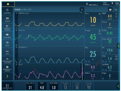Ventila&ccedil;&atilde;o SERVO-i com display NAVA mostrando sinal Edi (setas).