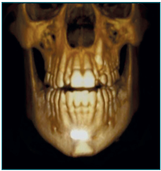 Imagem tridimensional frontal.