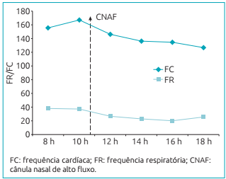 Redução da frequência cardíaca e da frequência respiratória após a utilização da cânula nasal de alto fluxo (seta pontilhada).