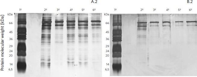 Gel with β-mercaptoethanol, stained with AgNO3, protein standard of 6.5 - 66 kDa molecular weights