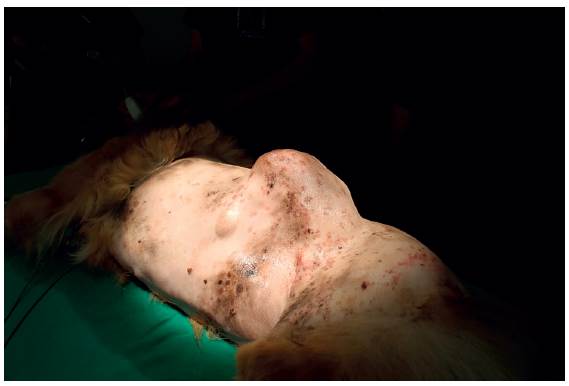 Aspecto preoperatorio de la masa. En la figura se puede apreciar la localizaci&oacute;n y extensi&oacute;n de la misma.