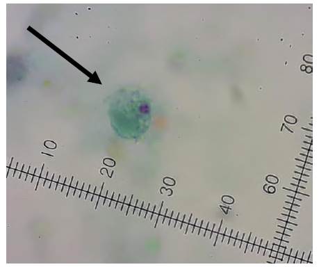 Trofozo&iacute;tos de Dientamoeba fragilis en materia fecal de porcinos. Tinci&oacute;n tricr&oacute;mica. Objetivo 100X.