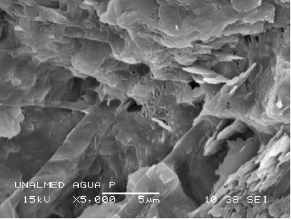 Microscopía de agua potabilizada; 5000 X. 