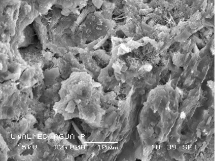 Microscopía de agua potabilizada; 2000 X.