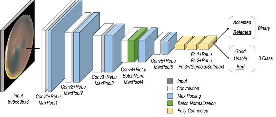 Deep learning model for the evaluation of eye fundus image quality.
