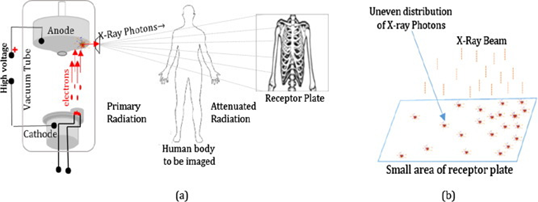 (a) X-ray imaging modality. (b) Uneven distribution of X-ray photons in a small area of the receptor plate [3].