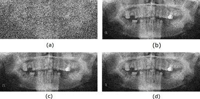 Noise Reduction in Image 29.png (a) Noisy Image (b) 2D-LMS (c), 2D-NLMS, (d) 2D- ARγ.