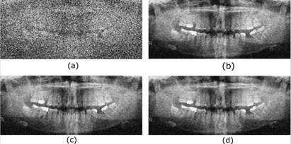 Noise Reduction in Image 58.png (a) Noisy Image (b) 2D-LMS (c), 2D-NLMS, (d) 2D- ARγ.